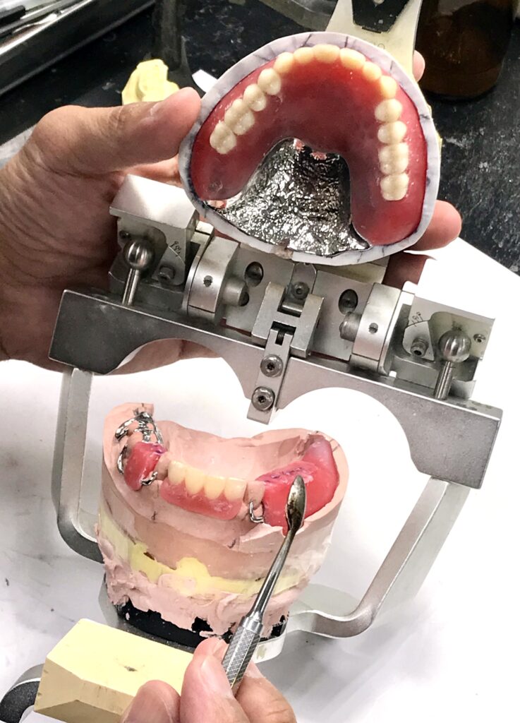 株式会社 日本キャストプレート | 金属床義歯専門技工所